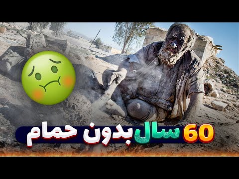 کثیف ترین فرد جهان عمو حاجی ایرانی که 60 سال حمام نرفته