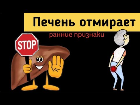 ПЕЧЕНЬ простыми словами.  Ранние признаки что ваша печень отмирает! Берегите себя и  свое здоровье.