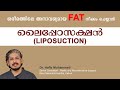      liposuction removes unwanted fat from body