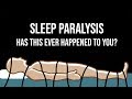 Sleep Paralysis: Facts You Must Know About This Terrifying Condition!