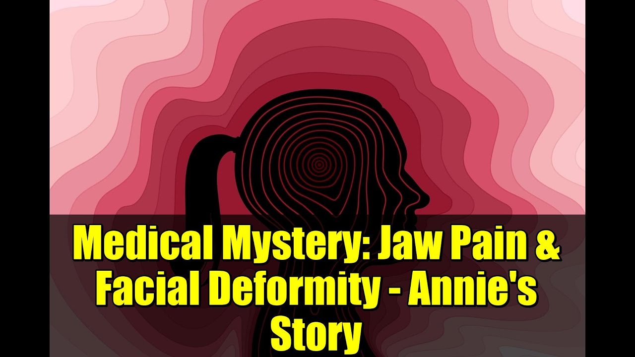 Medical Mystery: Jaw Pain & Facial Deformity - Annie's Story