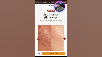 The Post-Purchase Offer That Quietly Raises Shopify LTV #shorts #shopifylandingpage