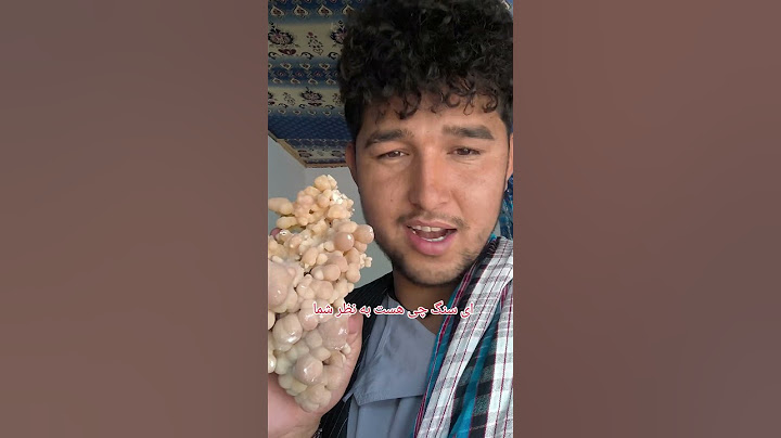 @Abbaorazgani نظر تان را درکمنت بیگوین این سنگ چی هست