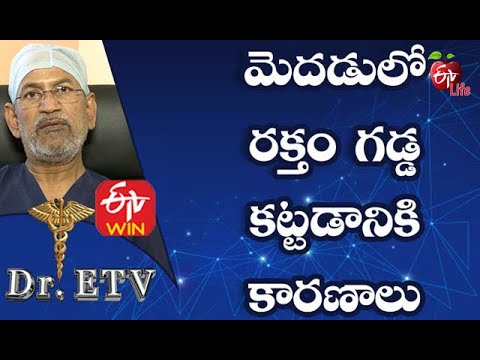 Hemorrhagic Stroke | మెదడులో రక్తం గడ్డ కట్టడానికి కారణాలు | Dr.ETV | 19th December 2020 | ETV Life