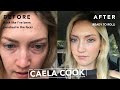 How to Cover Up Dark Eye Under Circles, Dark Troughs and Sunken in Eyes/ Conceal & Color Correct