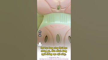 Ghế tựa lưng công thái học chống gù, điều chỉnh dáng ngồi chống vẹo cột sống  #ghechonggu #ghecongth