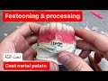 Festooning and processing an upper denture cast metal palate waxbae