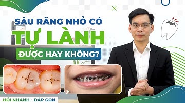 SÂU RĂNG NHỎ CÓ TỰ LÀNH ĐƯỢC KHÔNG? NÊN LÀM GÌ KHI MỚI BỊ SÂU RĂNG?