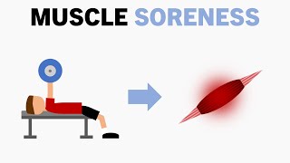 Is Soreness Beneficial for Muscle Growth?