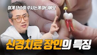 신경치료를 잘하는 의사란 어떤 의사일까?