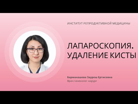 ЛАПАРОСКОПИЯ. УДАЛЕНИЕ КИСТЫ