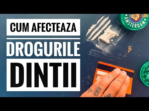 Cum Afecteaza Drogurile Dintii (cox, speed, boabe)