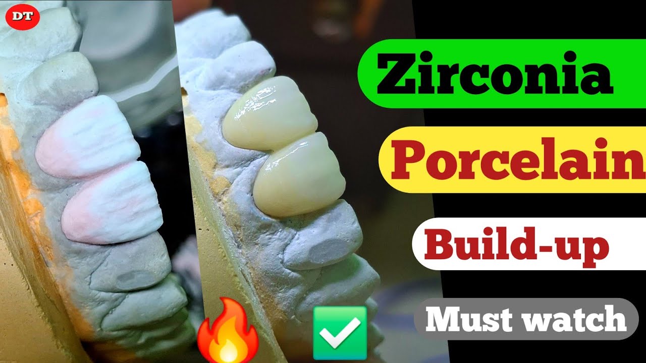 Zirconia Porcelain Build up|| Anterior layering| Dental lab| Exocad| Ceramic| posterior| porcelain 