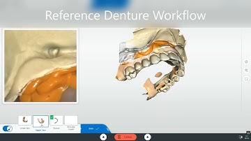 Reference Denture Workflow