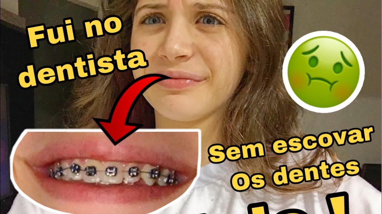 FUI COLOCAR APARELHO E ESQUECI DE ESCOVAR OS DENTES !!