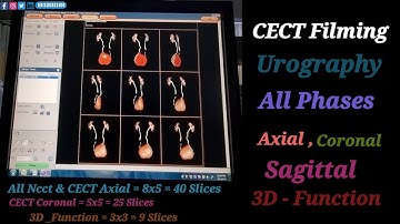 Cect Urography Filming | All Phases, delayed, 3D Functions | By Anis Qureshi