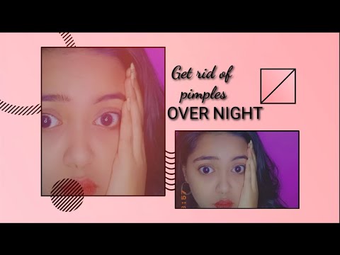 Get rid of pimples in ONE DAY |  ఒక రోజులో మొటిమలను వదిలించుకోవటం ఎలా | simple tips