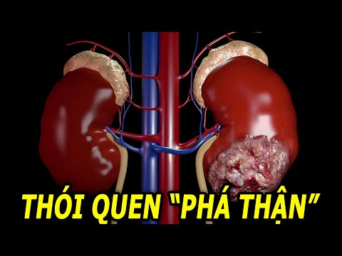 Video: Tuyến đường số 30: Đoàn thám hiểm Liên Xô chết như thế nào trên đường đến Biển Đen