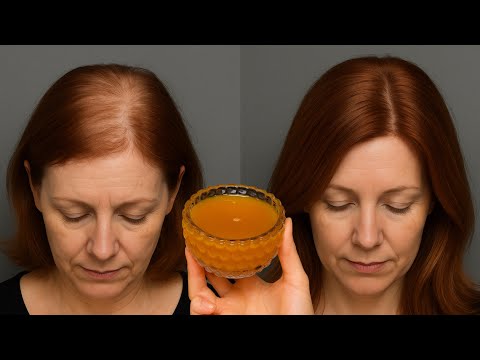 Grow Hair Like Crazy! Natural Anti-Hair Loss Masks That Work
