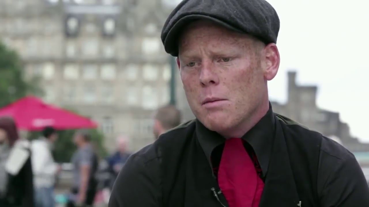 Rubberband Boy Interview at the Edinburgh Fringe Festival