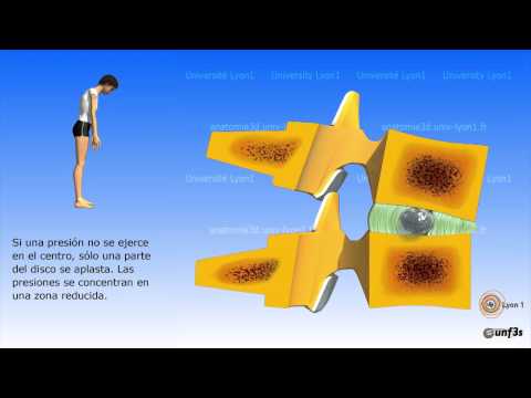 Vídeo: Anatomía, Función Y Diagrama Del Disco Intervertebral - Mapas Corporales