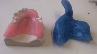 How to create a custom made bite block and tray