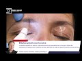 Blepharoplastie   dermaconcept