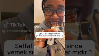 Şeffaf Plaklarda Yemek Kısıtlaması Var Mı?