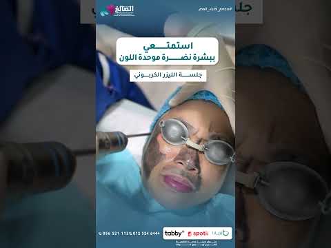 جلسة ليزر كربوني للوجه بمجمع أطباء العصر
