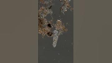 microscopy video - stentor