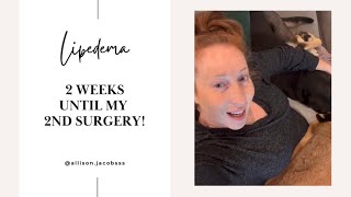 Answering Your Lipedema Reduction Surgery FAQS | Allison Jacobs
