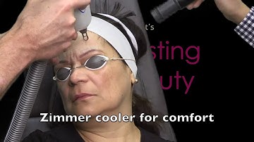 Erbium Laser for Full Face