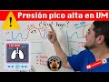 Se aumento la presión pico en el Ventilador mecánico! ¿Qué diablos hago?