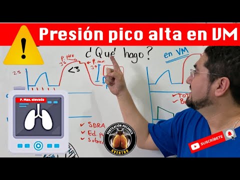 Video: ¿Deberían estar apretados los picos de las vías?