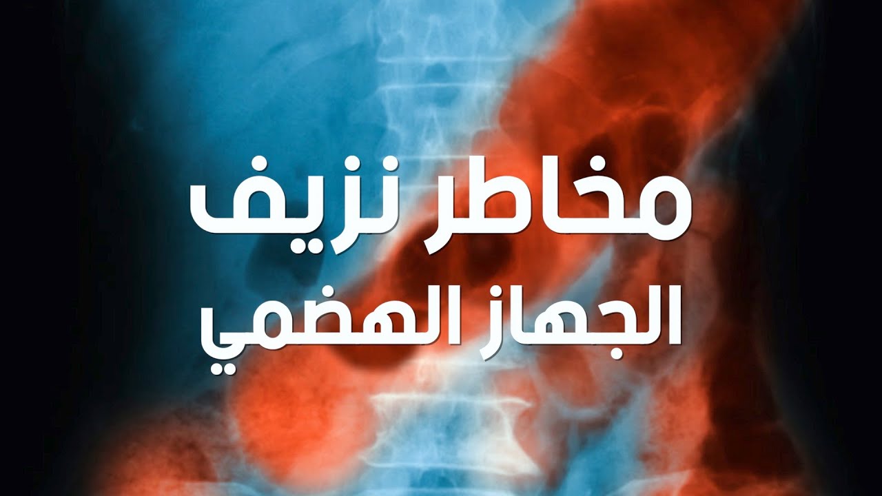 مخاطر النزيف الدموى للجهاز الهضمى