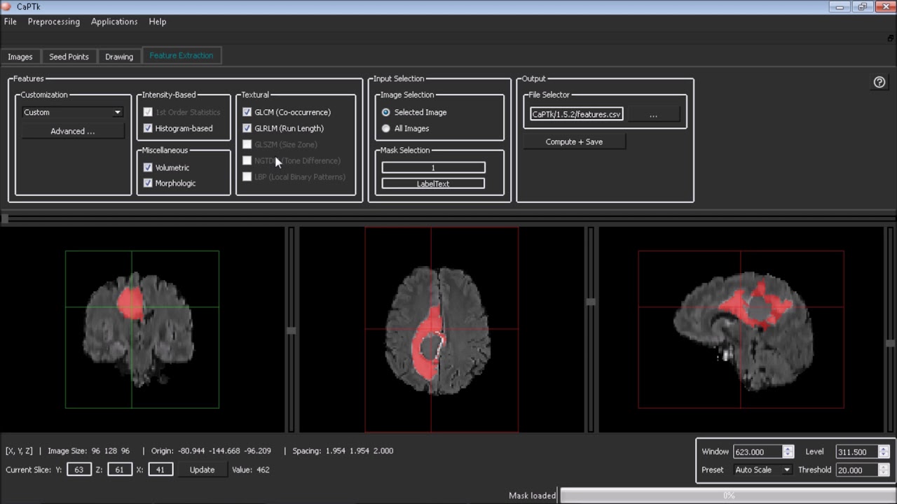 CBICA CaPTk: Quantitative Feature Extraction - YouTube