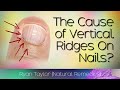 Do You Have Vertical Ridges On Your Nails? (Cause)