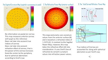 Lasik and Different Curvature Maps for IOL Power calculation (Website address : quickguide.org)
