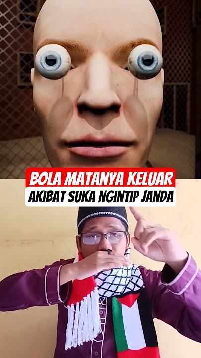 Akibat suka ngintip janda, Bola mata bapak ini keluar dan kabur #eyes #science #facts #scarystories