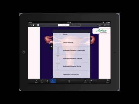 DrawMD OB/GYN iPad App Demo