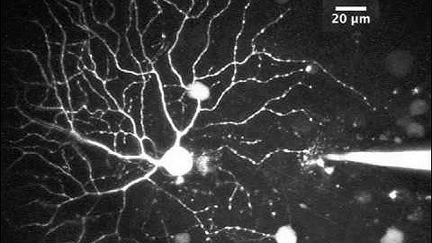 Two photon imaging in the PV retina