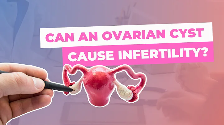 Can an ovarian cyst cause infertility?