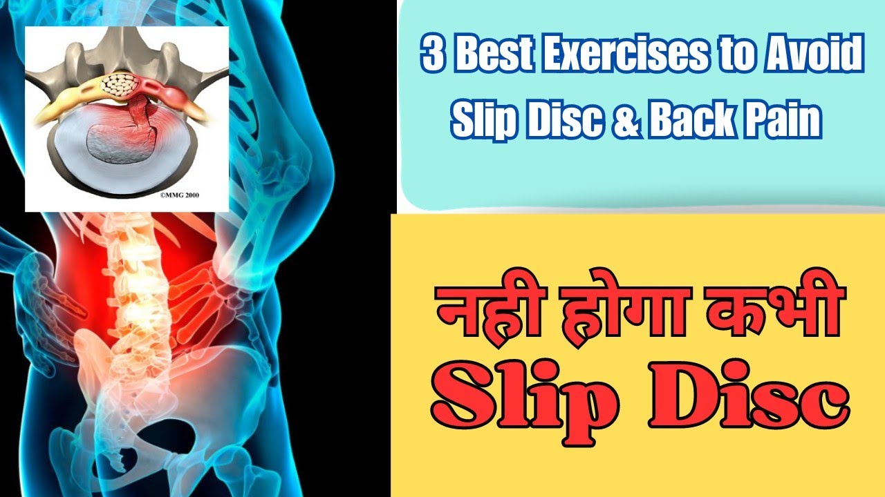 Best Exercises to Avoid Slip Disc !! Back Pain & Stiffness Exercises