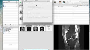 003 Optimising OsiriX Preferences.mov