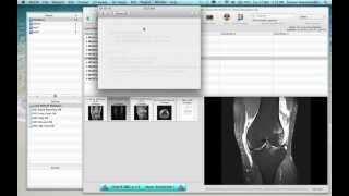 003 Optimising OsiriX Preferences.mov