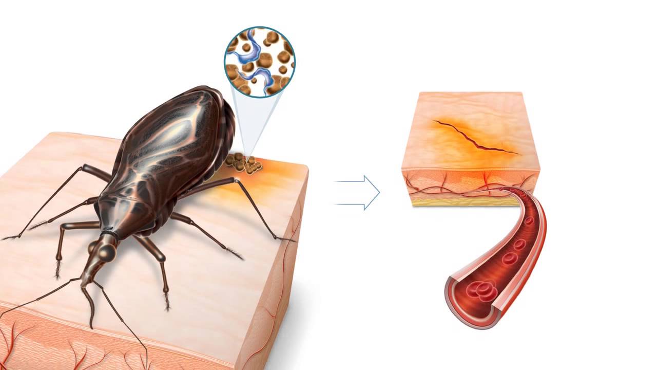 O Micro organismo Que Provoca O Mal De Chagas é Um
