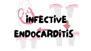 Infective Endocarditis in Under 20 Minutes | Pathology | Lectures by Omer