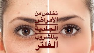 الحلقة الثالثة والعشرون /نور المعرفة/ تخلص من الأمراض الجلدية