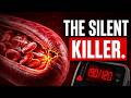 Silent Killer: Is Your BP Too High?