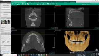 Построение панорамы в программе Ez3D i